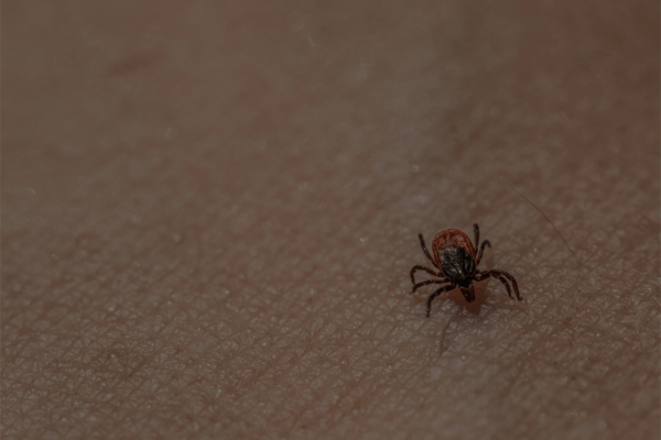 Close-up van een teek op de huid als illustratie van het risico op tekenencefalitis (TBE).